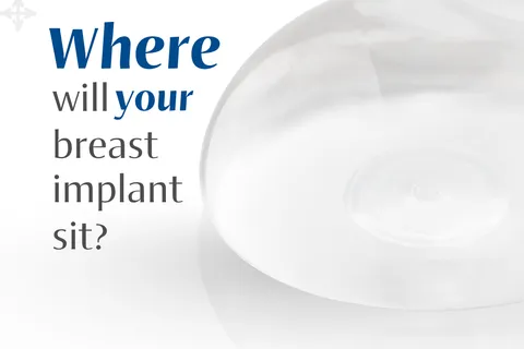 Content preview image