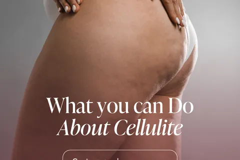 Content preview image