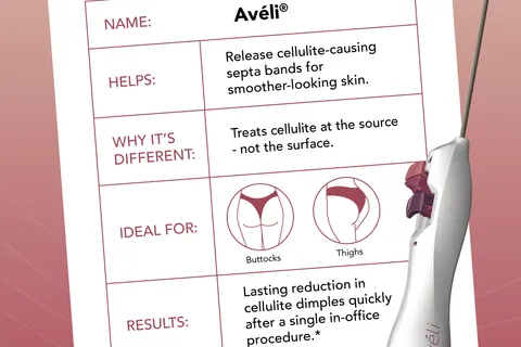 Content preview image