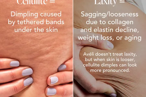 Content preview image