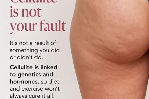 Content preview image