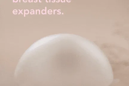 Content preview image