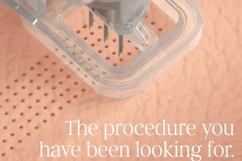 Content preview image