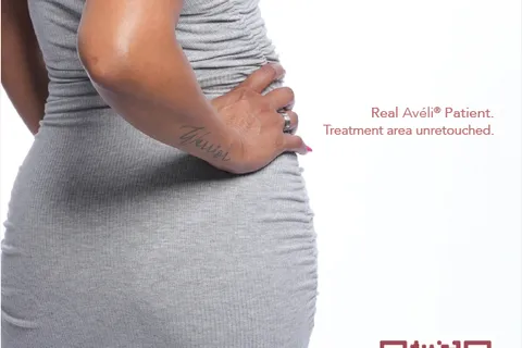 Content preview image