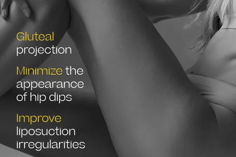 Content preview image