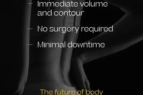 Content preview image