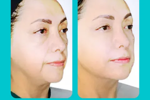 Content preview image