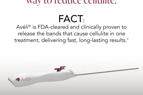 Content preview image