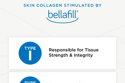 Content preview image