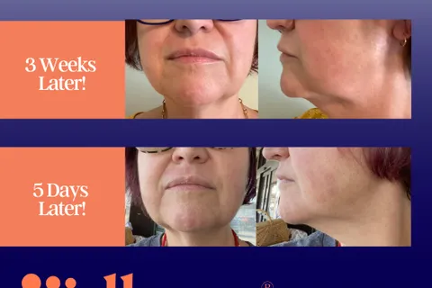 Content preview image