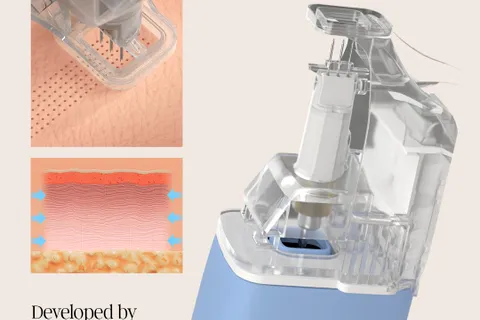 Content preview image