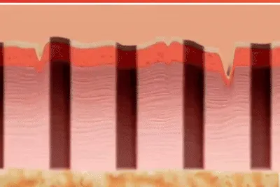 Content preview image