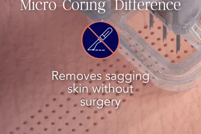 Content preview image