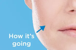 Content preview image