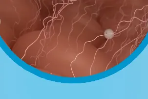 Content preview image