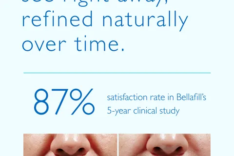 Content preview image