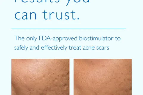 Content preview image