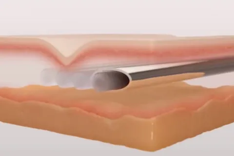 Content preview image