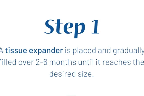 Content preview image