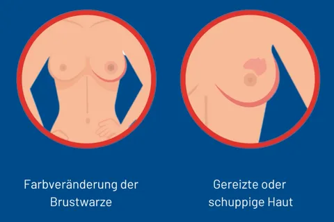 Content preview image