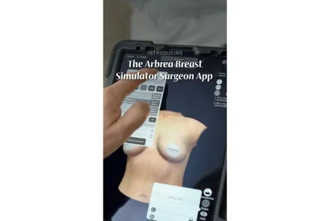 Content preview image