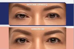 Content preview image