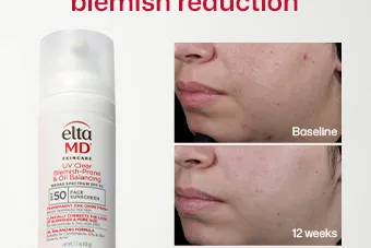 Content preview image