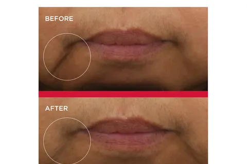 Content preview image