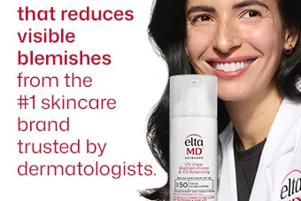 Content preview image