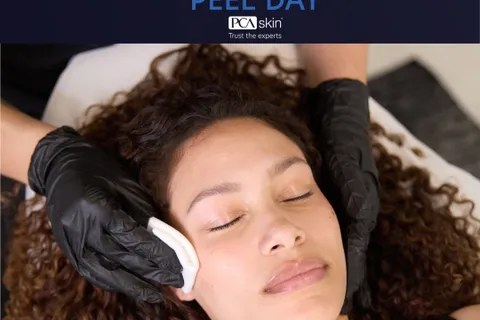 Content preview image