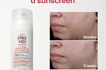 Content preview image