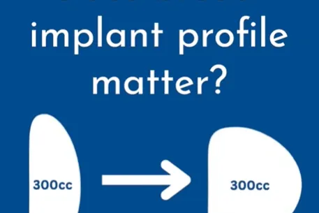 Content preview image