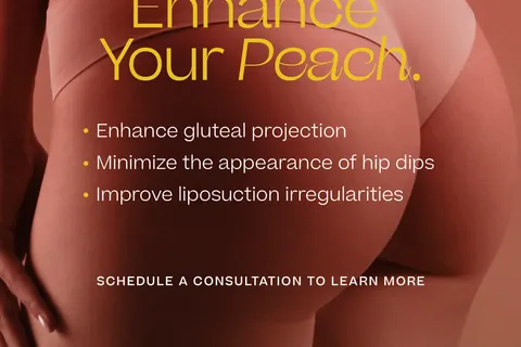 Content preview image