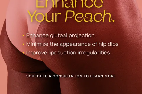 Content preview image
