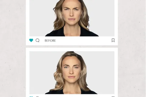 Content preview image